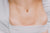 lady with scar in stomach