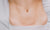 lady with scar in stomach